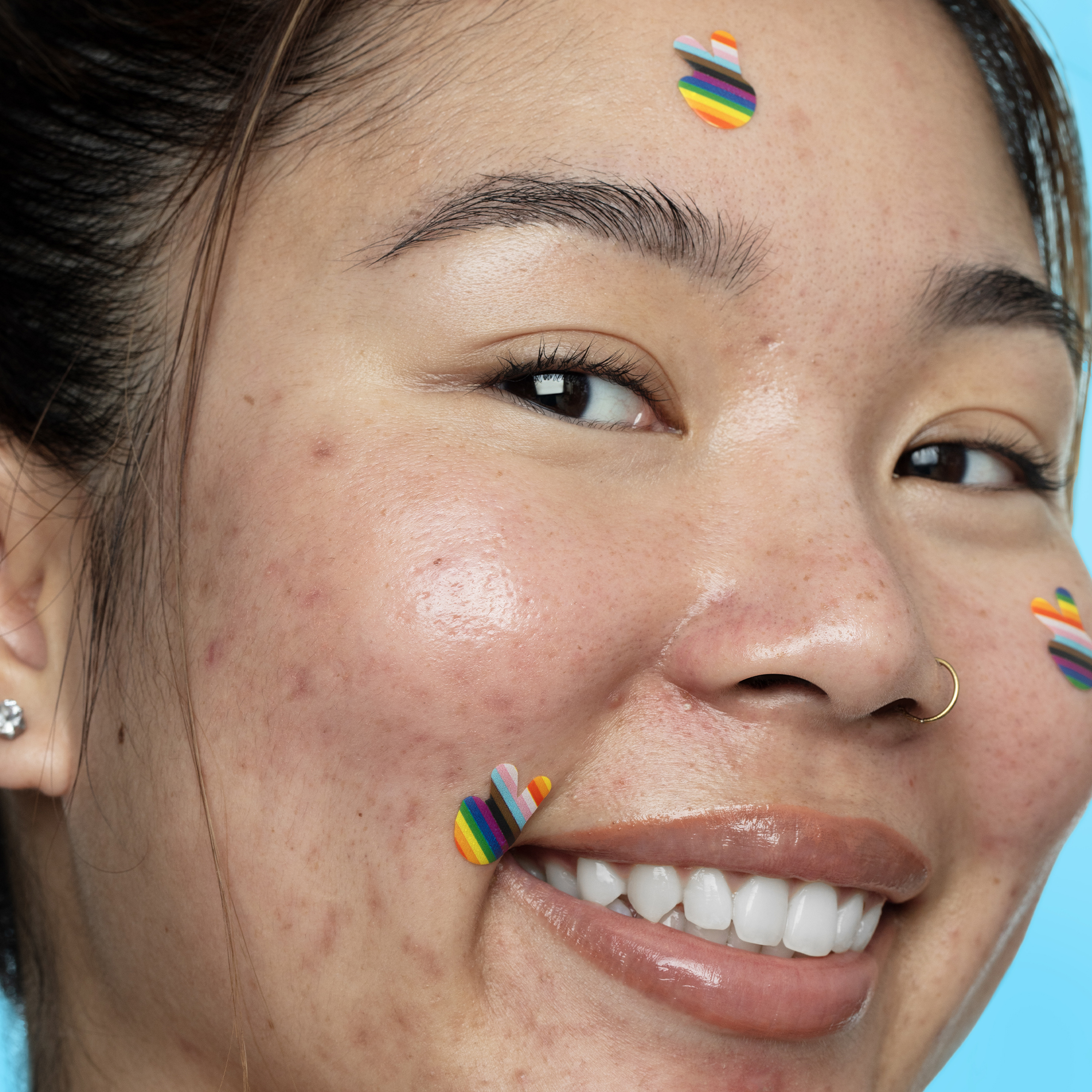 PRIDE ACNE HEALING DOTS (PARCHES ANTI-ACNÉ)